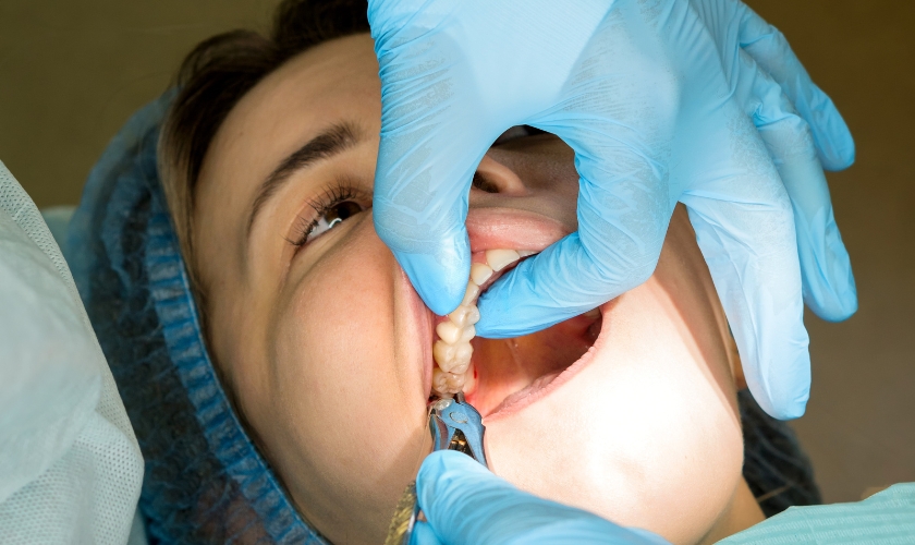 sinus cavity healing time after tooth extraction