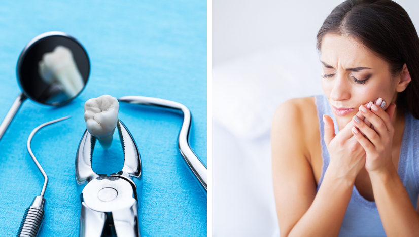 emergency tooth extraction your ultimate guide