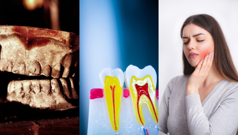 top 5 signs you might need a dental crown