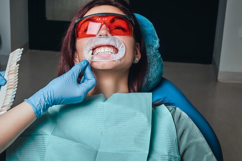 teeth-whitening-in-Houston