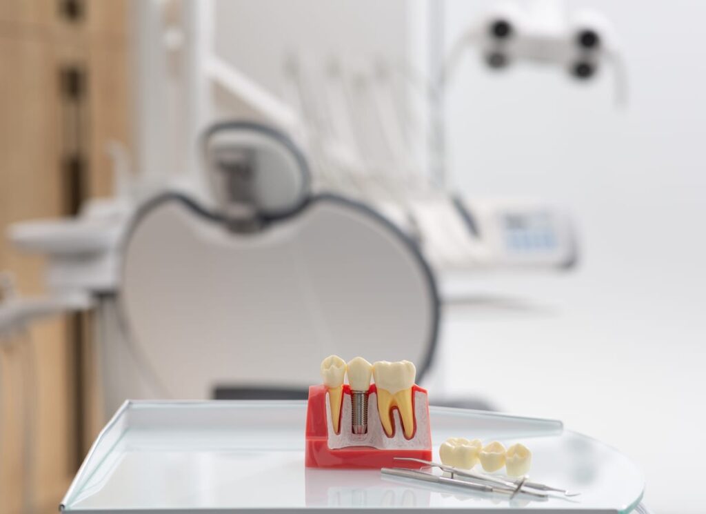 Dental Implants in Houston